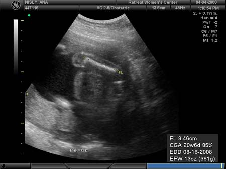 BABY_11
