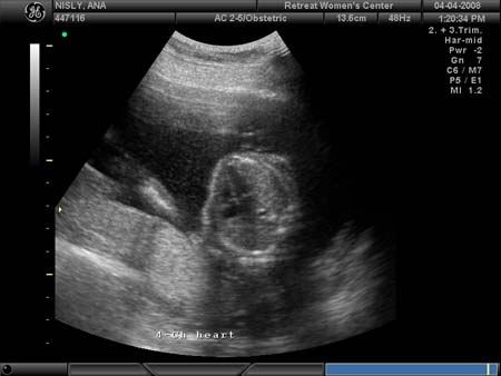 BABY_12