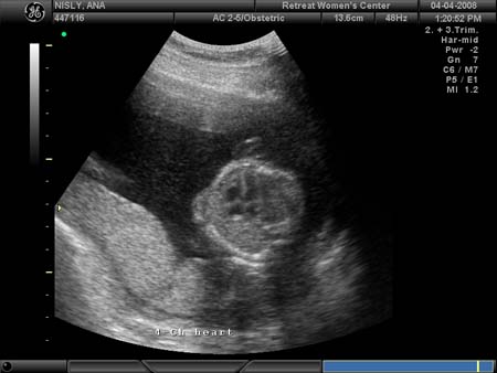 BABY_13