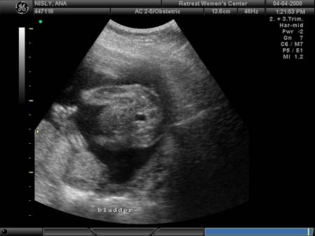 BABY_15