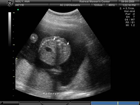 BABY_16