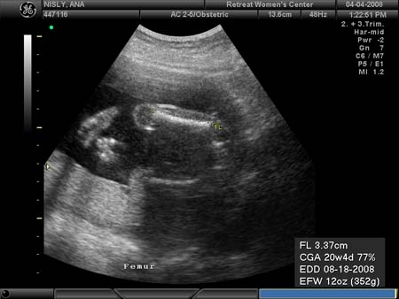 BABY_17