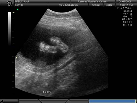 BABY_18