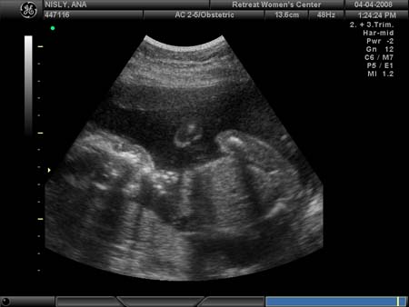 BABY_19