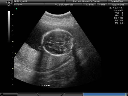 BABY_2