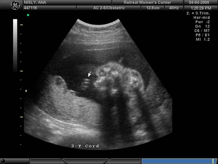 BABY_20