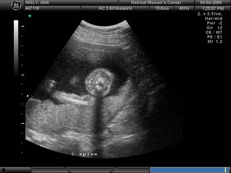 BABY_21