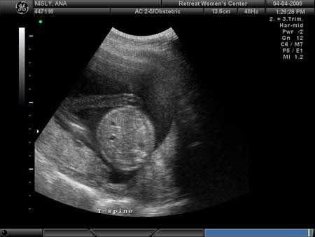 BABY_22