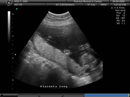 BABY_23