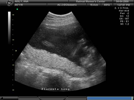 BABY_24