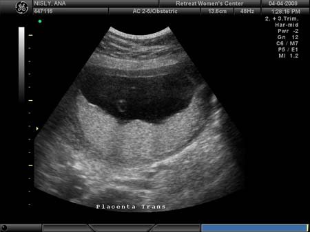 BABY_25