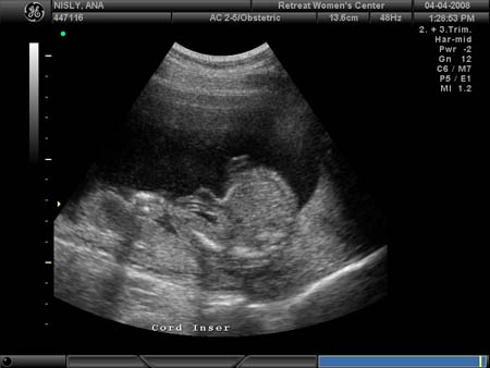 BABY_27