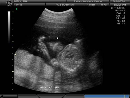 BABY_30