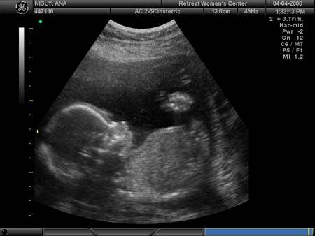 BABY_31