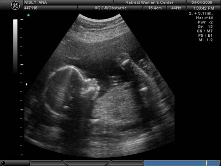 BABY_32