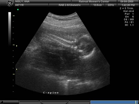 BABY_33