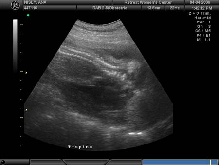 BABY_34
