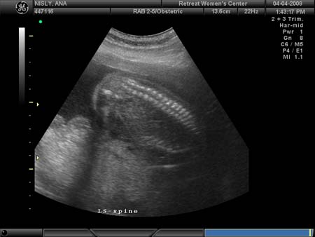 BABY_35