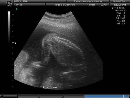 BABY_36