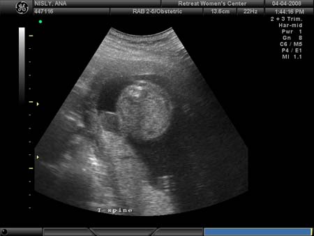 BABY_37