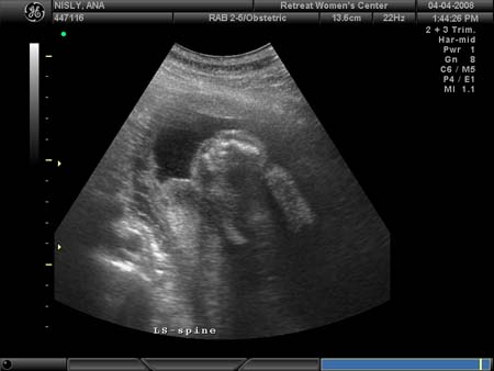 BABY_38