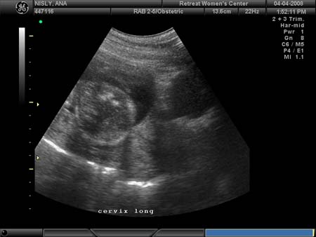BABY_39