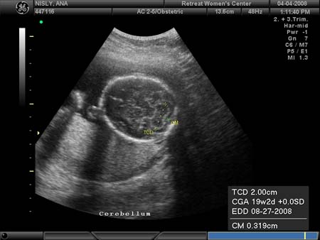 BABY_4