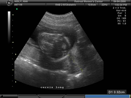 BABY_40