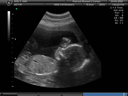 BABY_41
