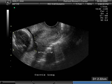 BABY_45