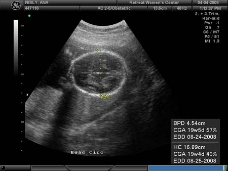 BABY_5