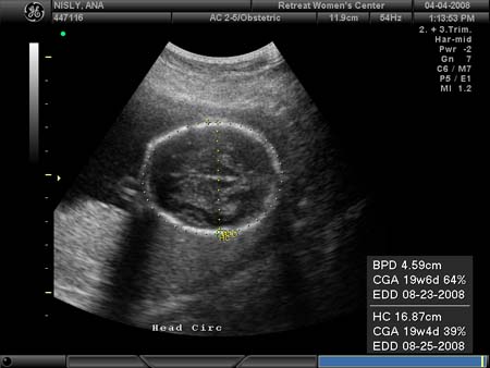 BABY_6