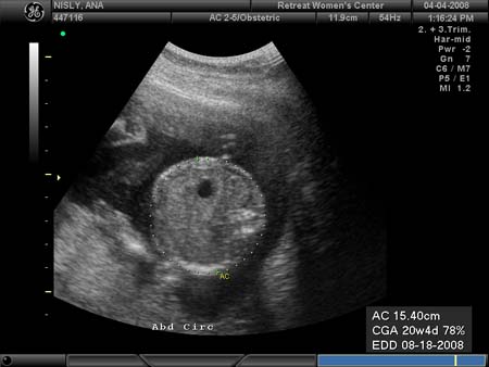 BABY_8