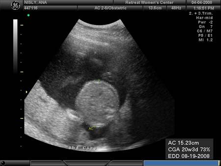 BABY_9