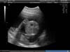BABY_10