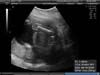 BABY_11