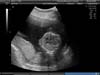 BABY_13