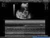 BABY_14