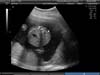 BABY_16