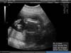 BABY_17