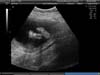 BABY_18