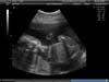 BABY_19