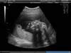 BABY_20