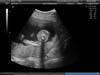 BABY_21