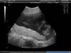 BABY_24
