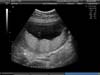 BABY_25