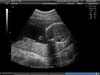 BABY_26