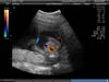 BABY_28