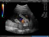 BABY_29