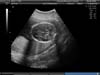 BABY_3
